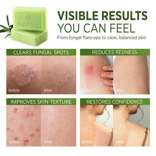 Tea Tree Oil Soap