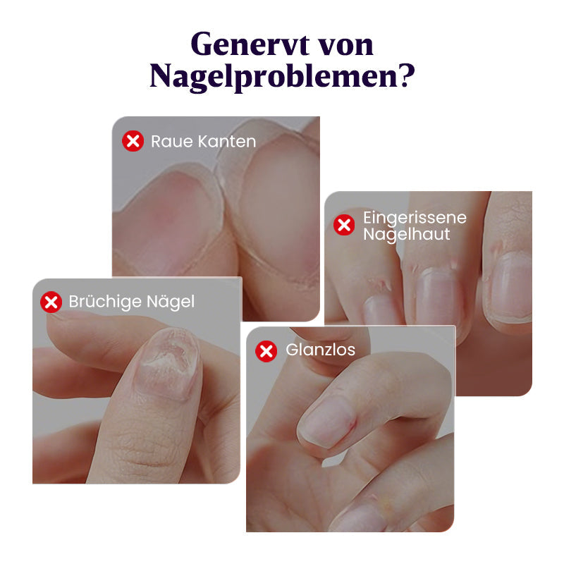 👍🧑‍⚕️Reparatur von Nagelschäden✨ „Duft + Maniküre + Schutz“ in EINEM tragbaren Nagelpflege-Stift💅