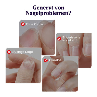 👍🧑‍⚕️Reparatur von Nagelschäden✨ „Duft + Maniküre + Schutz“ in EINEM tragbaren Nagelpflege-Stift💅