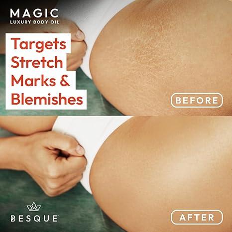 Besque Original Magic Body Oil, 3.4 FL OZ, After Shower Body Oil For Women, Hydrating Skin Care For Full Body That Plumps, Tightens, &amp; Firms Skin With Natural Ingredients, Luxury Spa Gifts - Pack of 1