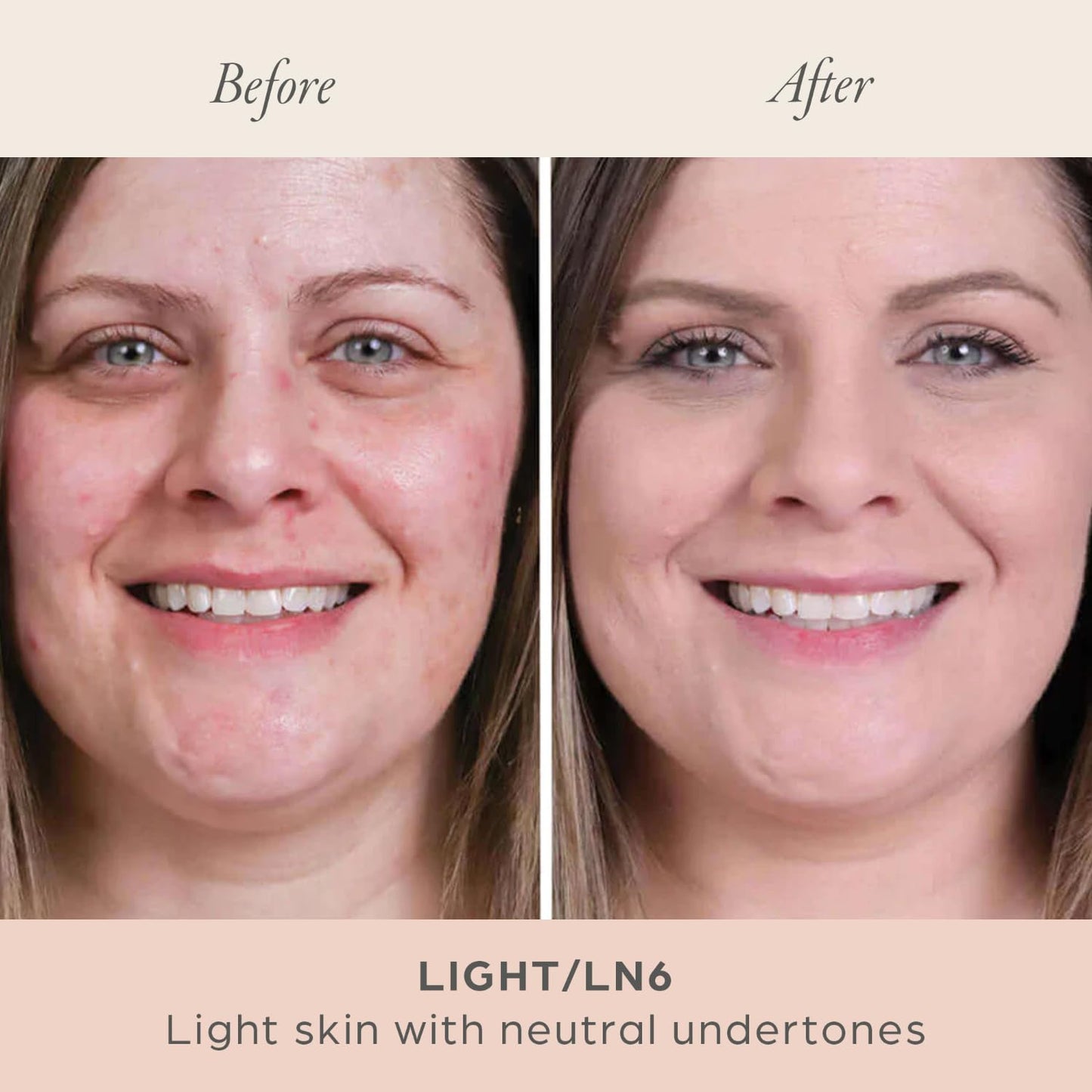 ⏳ LETZTER TAG KAUFEN 1, ERHALTE 1 GRATIS!! ⚡ ÜBER 50.000 VERKAUFT! ✨ Mrs Glam - Glorious Skin Puder-Foundation