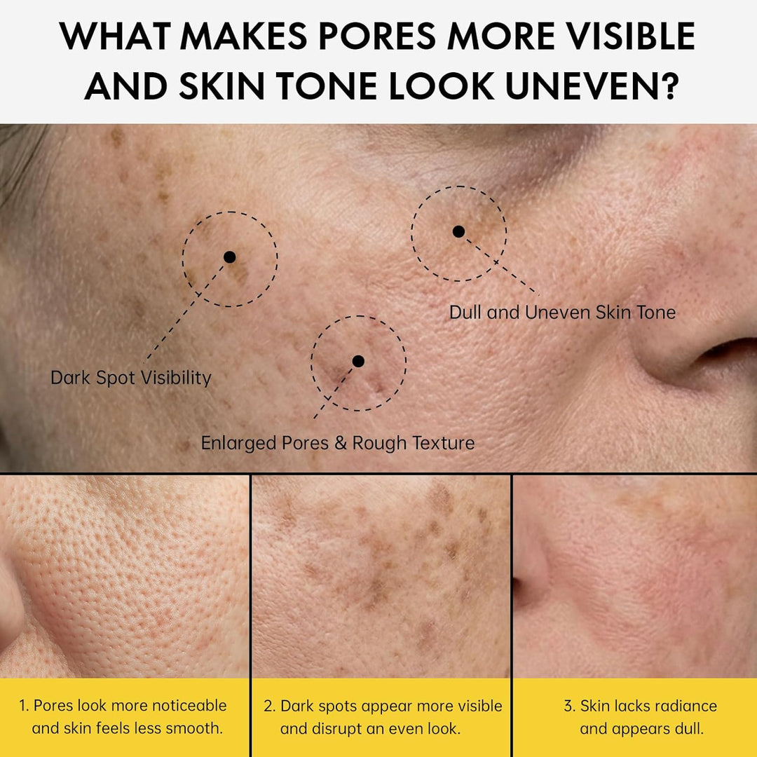 EELHOE Pores + Dark Spots Refining Cream with Arbutin, Niacinamide, Tranexamic Acid &amp; Melazero | Pore-Minimizing, Gentle &amp; Hydrating Daily Moisturizer, Suitable for Sensitive Skin, 50g (1 Pack)