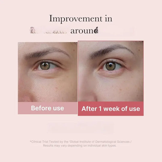 medicube Salmon DNA PDRN Pink Peptide Eye Serum with Niacinamide and 99% Purity Retinol for Fine Lines, Uneven Skin Tone, Korean Skin Care 1.01fl.oz