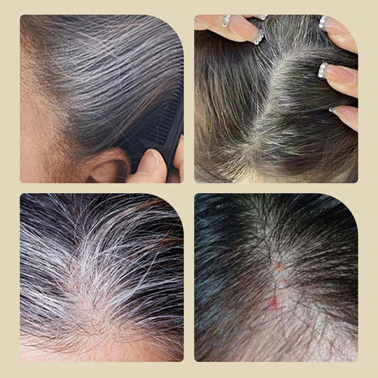 🥰🌟LAST DAY SALE: ONLY ￡9.99!!🎁✨Safe and Convenient Comb Hair Dye