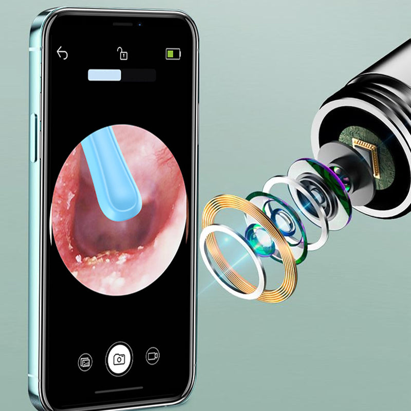 🏆Zeitlich begrenzter Rabatt👂Visualisiertes elektrisches Werkzeug zur Ohrenschmalzentfernung