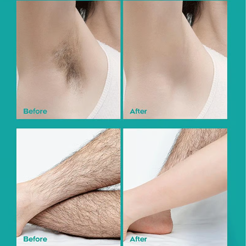 🧴✨ 2 KAUFEN, 1 GRATIS! 🌿💖 Schmerzfrei &amp; sanft: Haarentfernungscreme mit Aloe Vera – seidig glatte Haut in 8 Minuten, perfekt für empfindliche Haut.